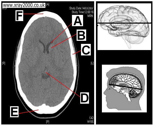 AXIAL SECTION 6.JPG